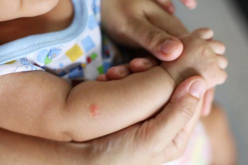 Sốt xuất huyết ở trẻ sơ sinh dễ nhầm với bệnh khác