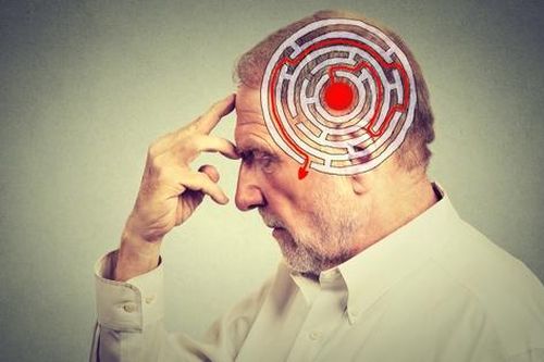 Hợp chất trong trà xanh và rượu vang có thể làm chậm sự tiến triển của bệnh Alzheimer