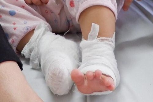 Phòng tránh tai nạn ở trẻ nhỏ khi mùa đông đến