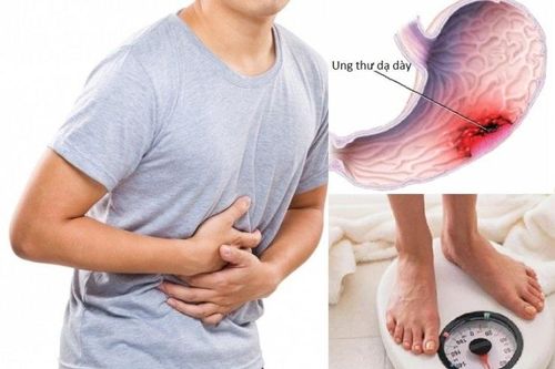 5 dấu hiệu không đau nhưng cảnh báo ung thư dạ dày