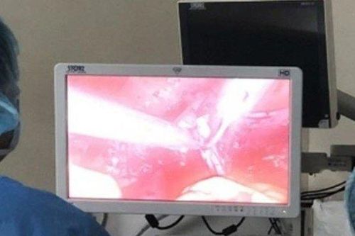 Căn bệnh khiến cụ bà 93 tuổi bị ra máu âm đạo kéo dài,phải cắt tử cung