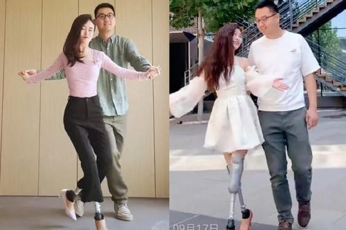 Nữ vũ công cụt chân, khiêu vũ nhờ đôi chân giả