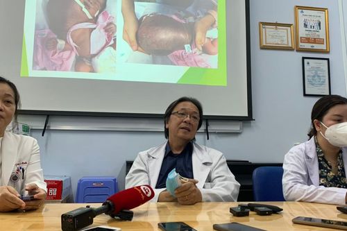 Phẫu thuật thành công khối u bạch huyết hơn 1,1kg cho em bé 3 ngày tuổi