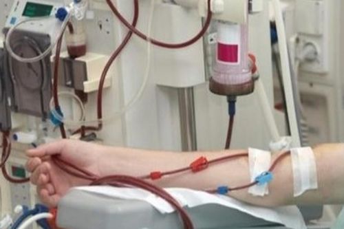 Liên tục lọc máu để cứu sống trẻ bị rối loạn chức năng đa cơ quan