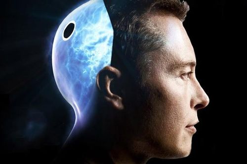 Elon Musk sắp cấy chip máy tính vào não người