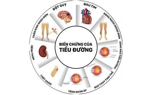 Tìm được độ tuổi khám phát hiện nguy cơ mắc tiểu đường sớm, giảm biến chứng