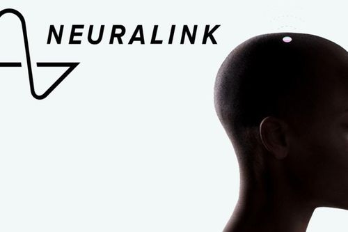 Tỷ phú Elon Musk khẳng định sẽ cấy chip não Neuralink