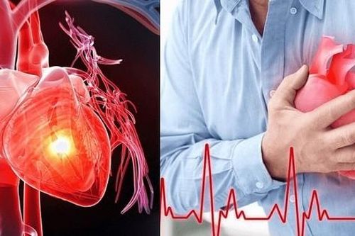 Lạnh đột ngột, người mắc bệnh tim mạch nhất định phải biết điều này để phòng bệnh tái phát