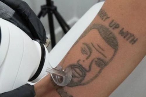 Xóa miễn phí hình xăm Kanye West
