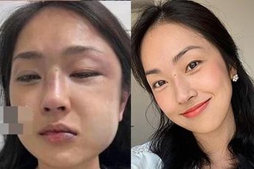 MC Mi Soa Kim Anh tố bị hành hung