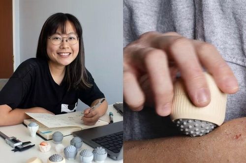 Cô gái thiết kế thiết bị gãi ngứa cho bệnh nhân chàm