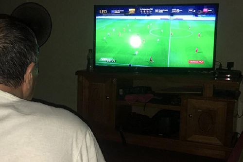 Thức thâu đêm xem World Cup, chàng trai bàng hoàng trước khuôn mặt 'biến dạng'