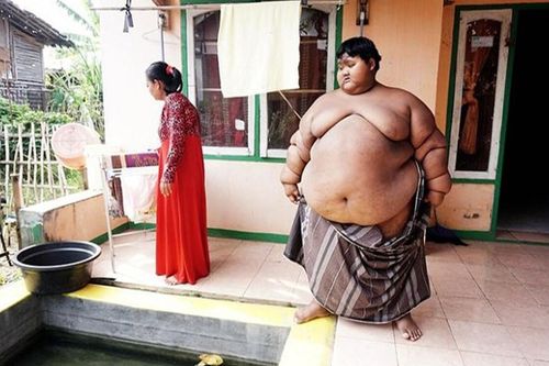 Màn 'lột xác' khó tin của cậu bé béo nhất thế giới
