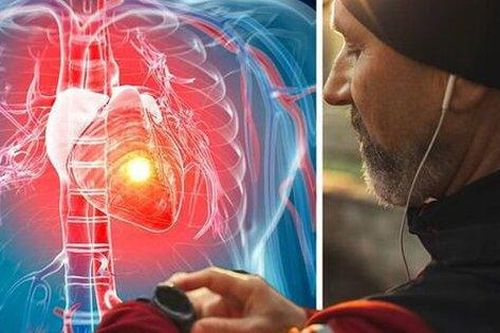 Nghiên cứu mới: Tập thể dục buổi sáng có thể làm giảm nguy cơ đau tim và đột quỵ