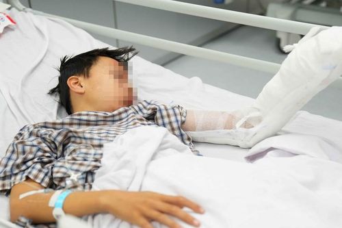 Nổ bình gas mi ni, bé trai nát 1 bàn tay, bỏng mặt