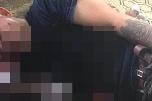 Sau tiếng nổ lớn tại quán cà phê, người đàn ông bị thương nguy kịch