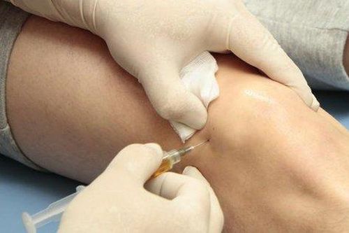 Có nên tiêm steroid trị viêm khớp gối?