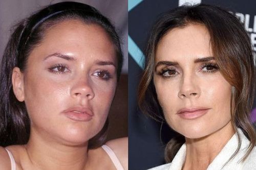 Victoria Beckham lên tiếng về tin đồn sửa mũi