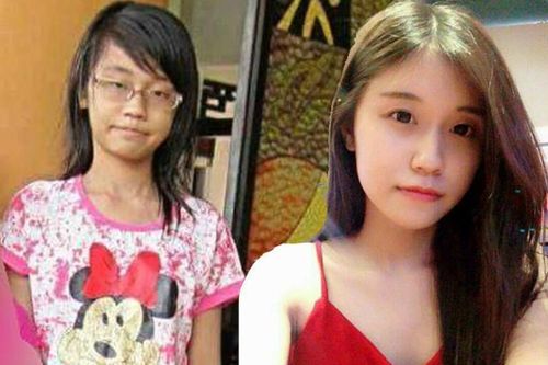 'Dậy thì thành công' gây ngỡ ngàng như 2 người khác nhau