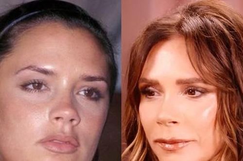 Thủ thuật đánh lừa của Victoria Beckham
