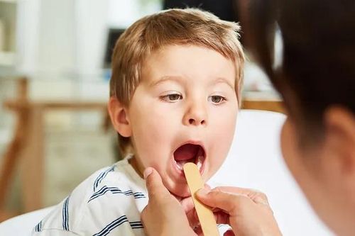 Liên cầu khuẩn nhóm A lây lan như thế nào?