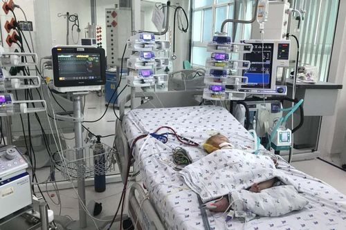 Can thiệp ECMO cứu bệnh nhi sốc sốt xuất huyết