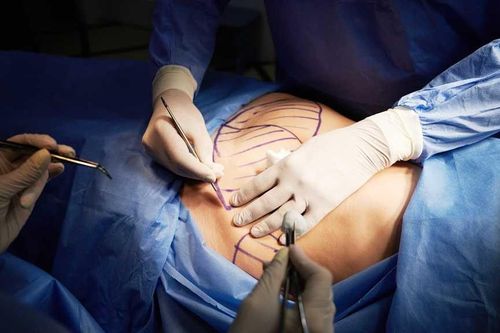 Cơ sở hút mỡ khiến cô gái 25 tuổi tử vong chỉ đăng ký 'chăm sóc da'