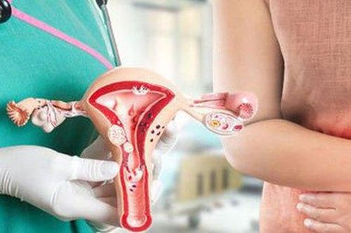 Những thói quen tai hại dễ gây viêm nhiễm đường sinh dục ở nữ giới