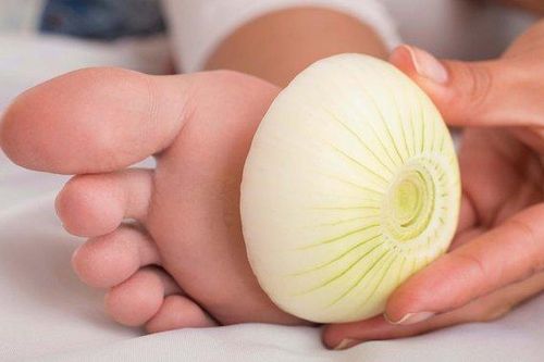 Bỏ hành tây vào tất và đi qua đêm có giúp điều trị bệnh cúm không?