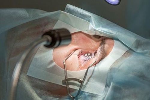 Cảnh báo những rủi ro có thể xảy ra sau phẫu thuật LASIK