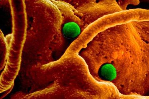 'Cúm lạc đà' - Hội chứng hô hấp Trung Đông coronavirus (MERS-CoV), phòng ngừa thế nào?
