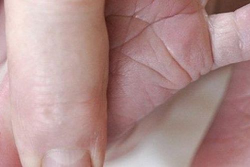 Sàng lọc sơ sinh để phát hiện, điều trị sớm bệnh lý di truyền cho trẻ