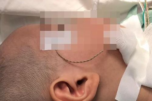 Giải thoát bé trai khỏi cuộc đời câm điếc bẩm sinh