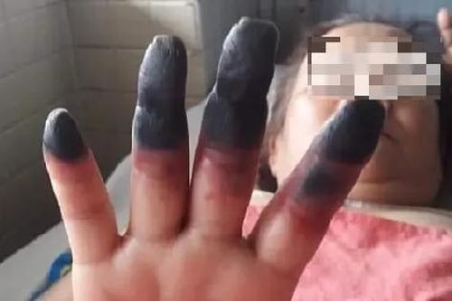 Đau nhức chân tay coi chừng bệnh lý nguy hiểm