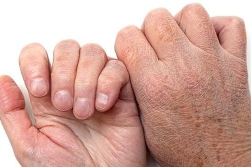 Cảnh báo tình trạng da nứt nẻ, ngứa ngáy trong mùa lạnh