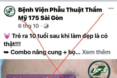 Cảnh báo mạo danh Bệnh viện Quân y 175 để trục lợi