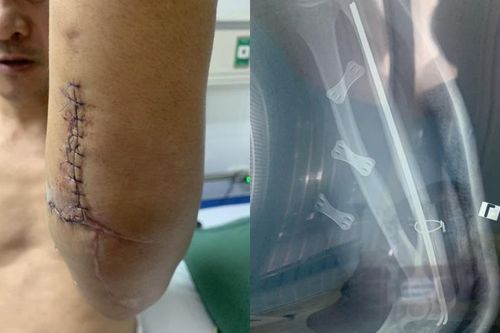 Đi tìm người nhắn tin gạ tình vợ, chồng bị chém trọng thương
