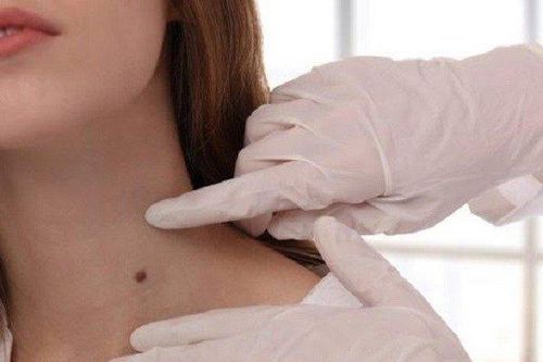 Qua đời sau chưa đầy nửa tháng nhận kết quả mắc ung thư