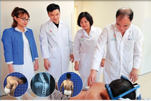 Cắt xương sườn giúp người đàn ông gù vẹo cột sống hơn 10 năm đi lại bình thường