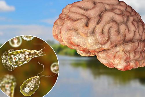 Sự nguy hiểm của 'amip ăn não' sau khi Hàn Quốc ghi nhận ca tử vong đầu tiên