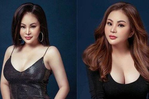 'Bà xã Trấn Thành' tiếp tục thẩm mỹ sau 10 lần sửa mũi, 2 lần độn cằm