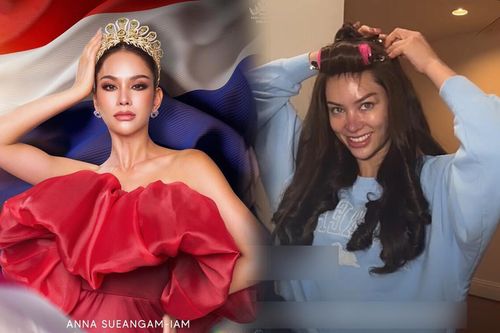 Miss Universe Thailand 'hiện nguyên hình' mặt mộc kém sắc trên livestream, đầu mũi thâm tím đáng lo ngại