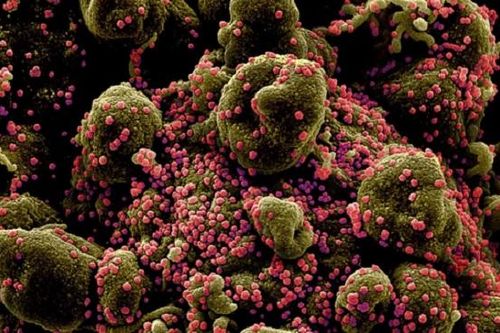 Phát hiện sinh vật đầu tiên trên thế giới chỉ ăn virus để sống