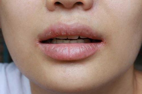 2 dấu hiệu xuất hiện cả ngày lẫn đêm chính là do bệnh tiểu đường, không cần xét nghiệm cũng biết