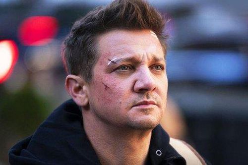 Tài tử Hawkeye bị xe ủi cán qua chân, phải phẫu thuật 2 lần vì bão tuyết kinh hoàng
