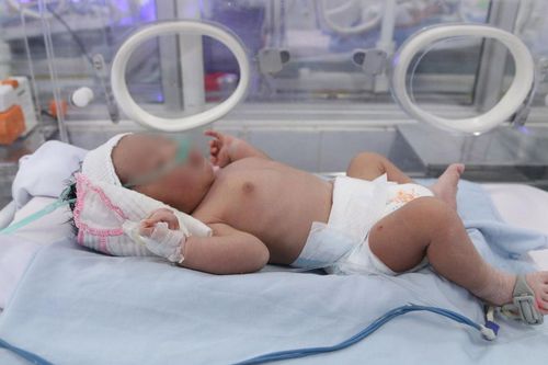 Bé trai bị bỏ rơi trong túi nilon ven đường