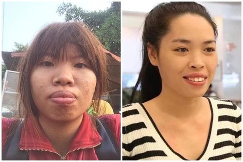 Loạt hiện tượng mạng 'dao kéo', đổi mặt đổi cả đời