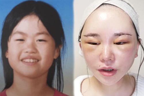 Diện mạo 'bất ngờ' của nữ idol Nhật sau 12 năm chi tiền tỷ làm phẫu thuật để 'giống người thường'