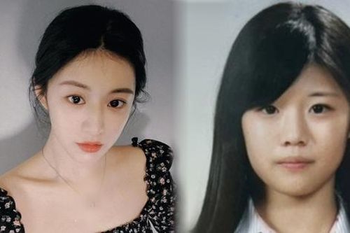 Netizen bênh vực Go Yoon Jung trước cáo buộc thẩm mỹ cả mặt