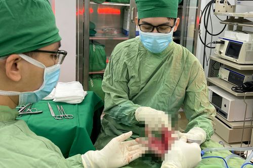 Nối bàn tay bị dập nát do máy cắt đá